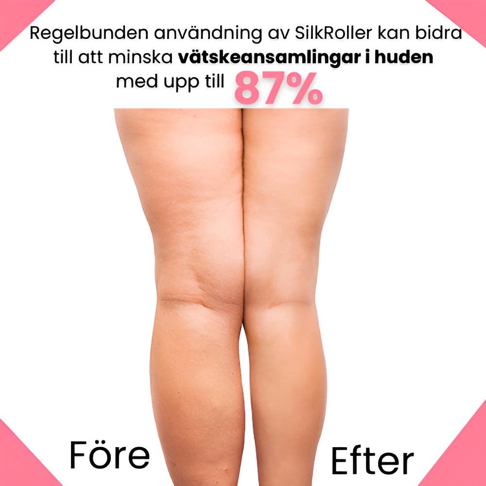 SilkRoller - Enklaste vägen till slätare hud!